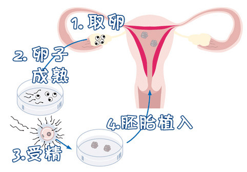 光愈生殖医学中心